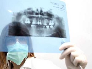 Anaesthesie bei der Entfernung der Weisheitszaehne