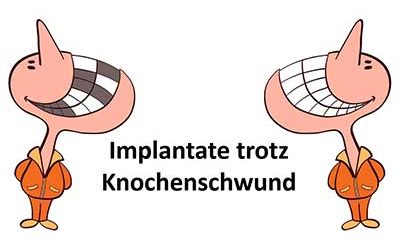Alles über Implantate 5 Wenn Knochen fehlt