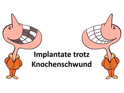 Implantet trotz knochenschwund
