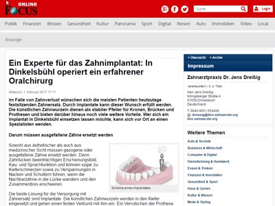 Praxis in den Medien 2 Medien artikel Focus oralchirurg