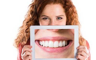 Alles über schöne Zähne 12 Veneers das Geheimnis des Hollywood Lächelns