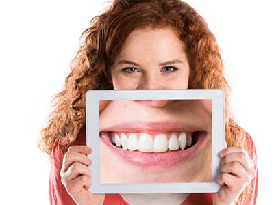schoene-zaehne-veneers-180420091217